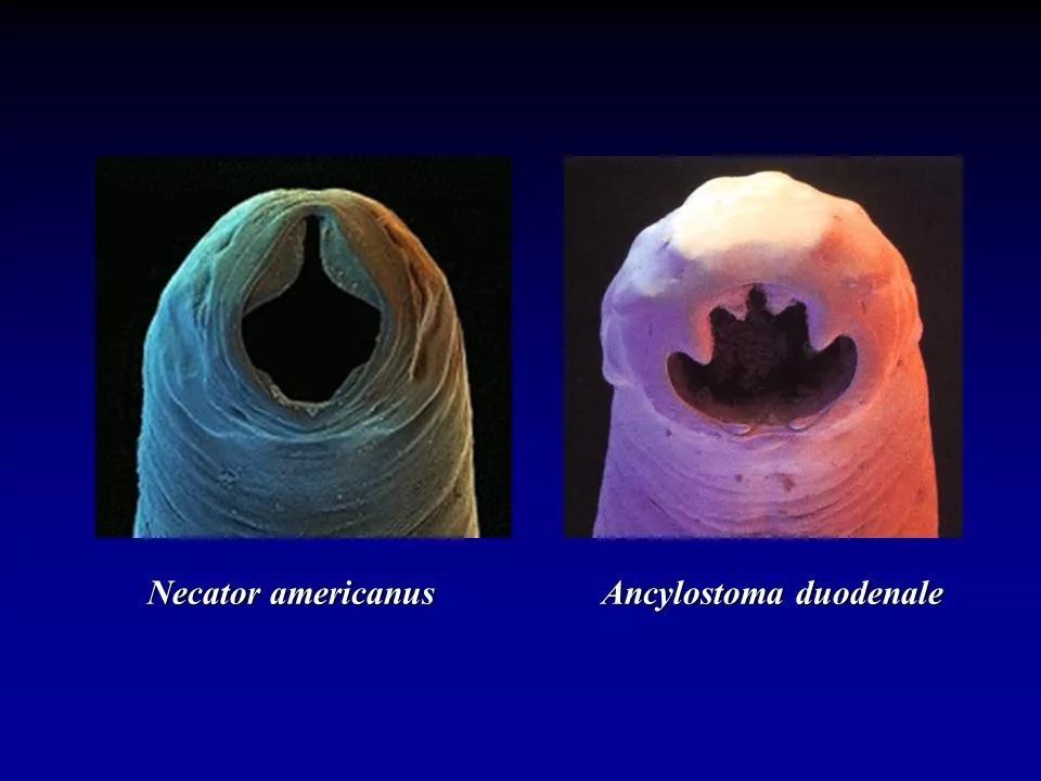 吃虫子减肥,减肥吃虫子的方法