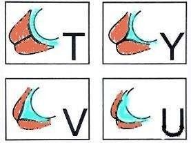 宫颈松能自行恢复么,医生说我宫颈小是好事儿吗