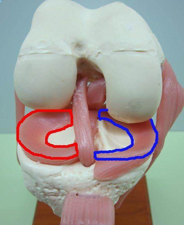 半月板像肉筋还是板筋,半月板最容易损伤的瞬间