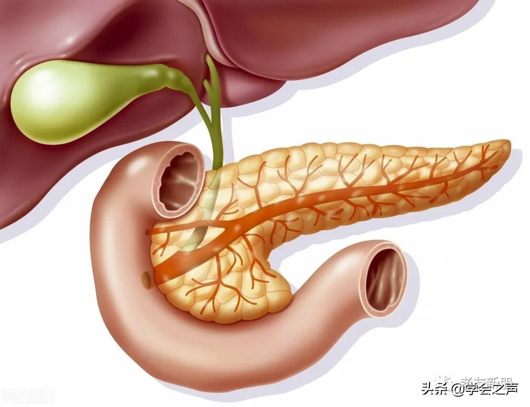 胰腺癌:起病急,死亡率高!有这3种症状需警觉