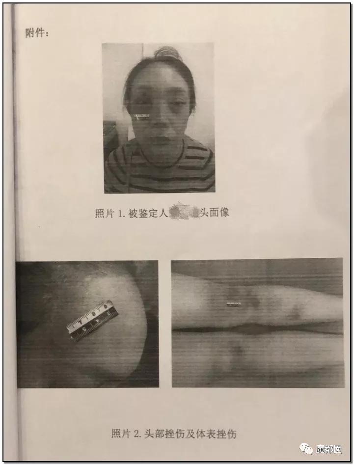 短跑名将张培萌家暴事件,短跑名将张培萌殴打岳母视频