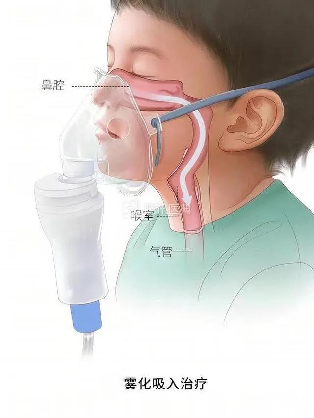 孩子突然喉咙哑怎么回事,孩子突然嗓子哑了吃点什么药