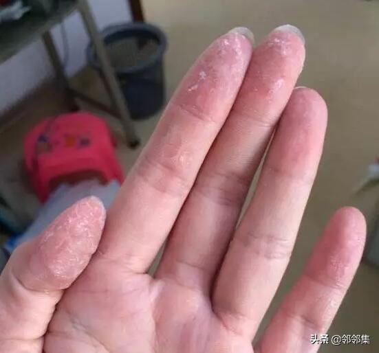 手机开机键被502胶水粘住怎么办,502胶水把衣服黏住了变硬怎么办