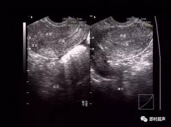 盆底超声可检查什么疾病,哪些疾病需要做妇科检查