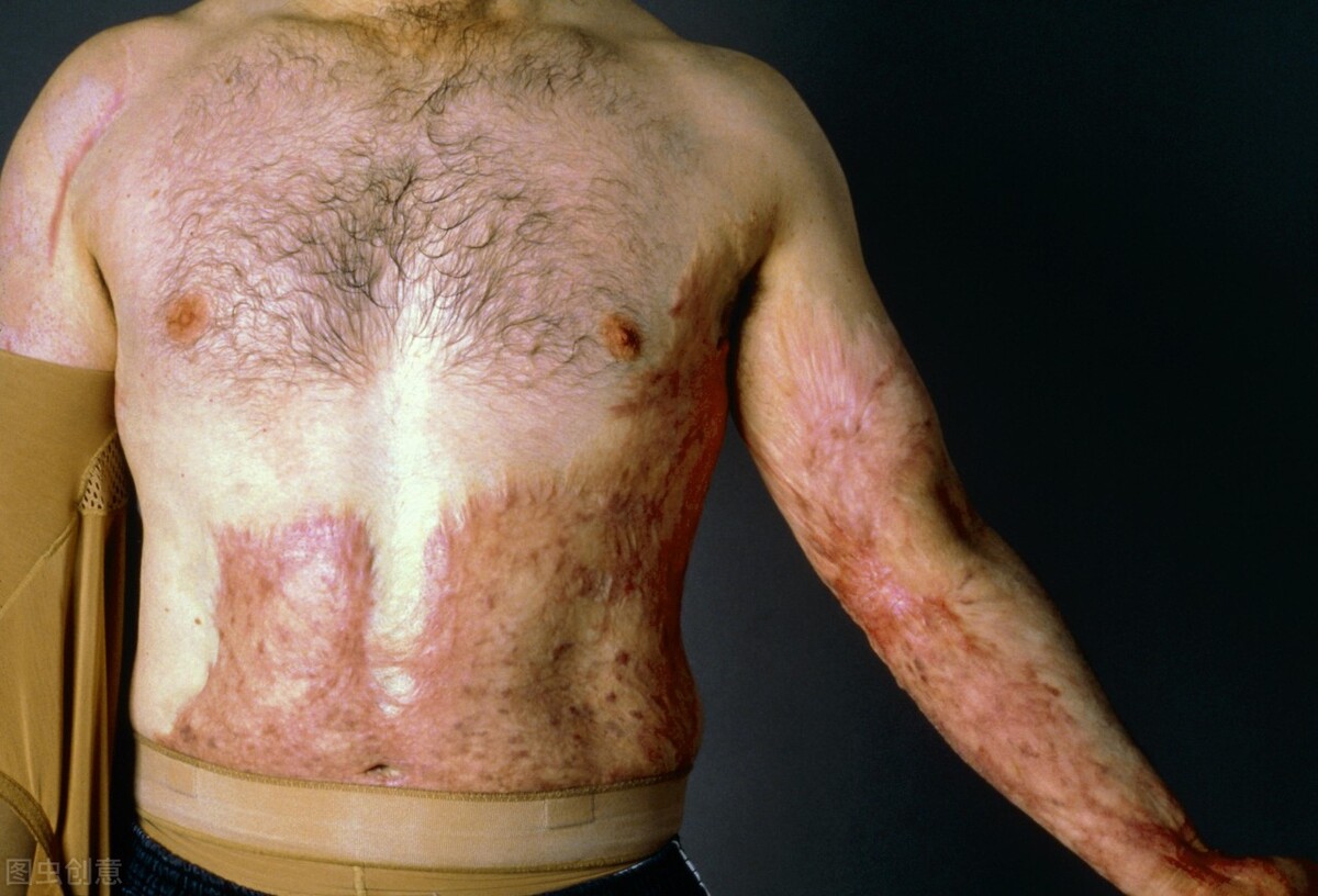 发生工伤公司没钱赔偿怎么办,发生工伤对方没钱怎么办