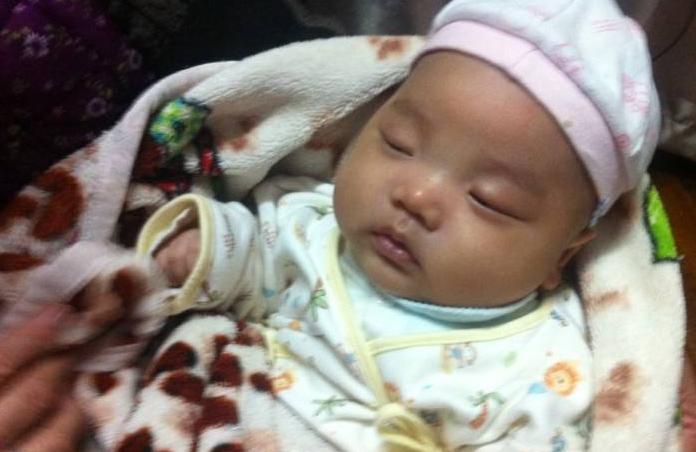 宝宝长期调理脾胃为什么脸色还黄,脾胃虚脾胃消化弱脸上有什么表现