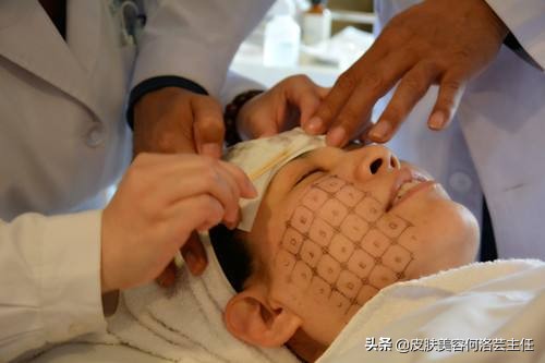 热玛吉操作时正确的手法,热玛吉医生操作时有技巧吗