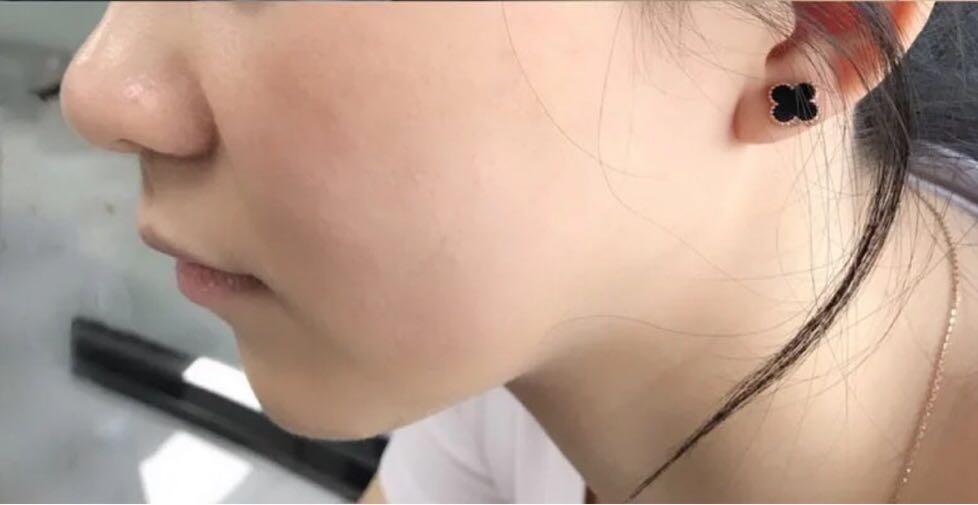 毛孔粗大有黑头适合什么粉底液,遮盖粗大毛孔黑头用什么粉底液