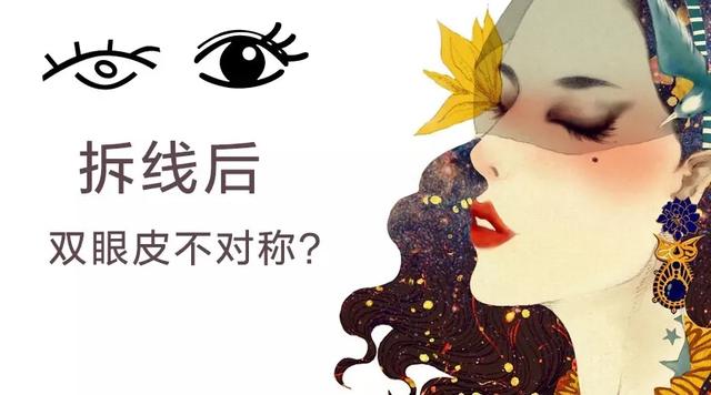 双眼皮拆线后不对称怎么回事,拆线后双眼皮不对称