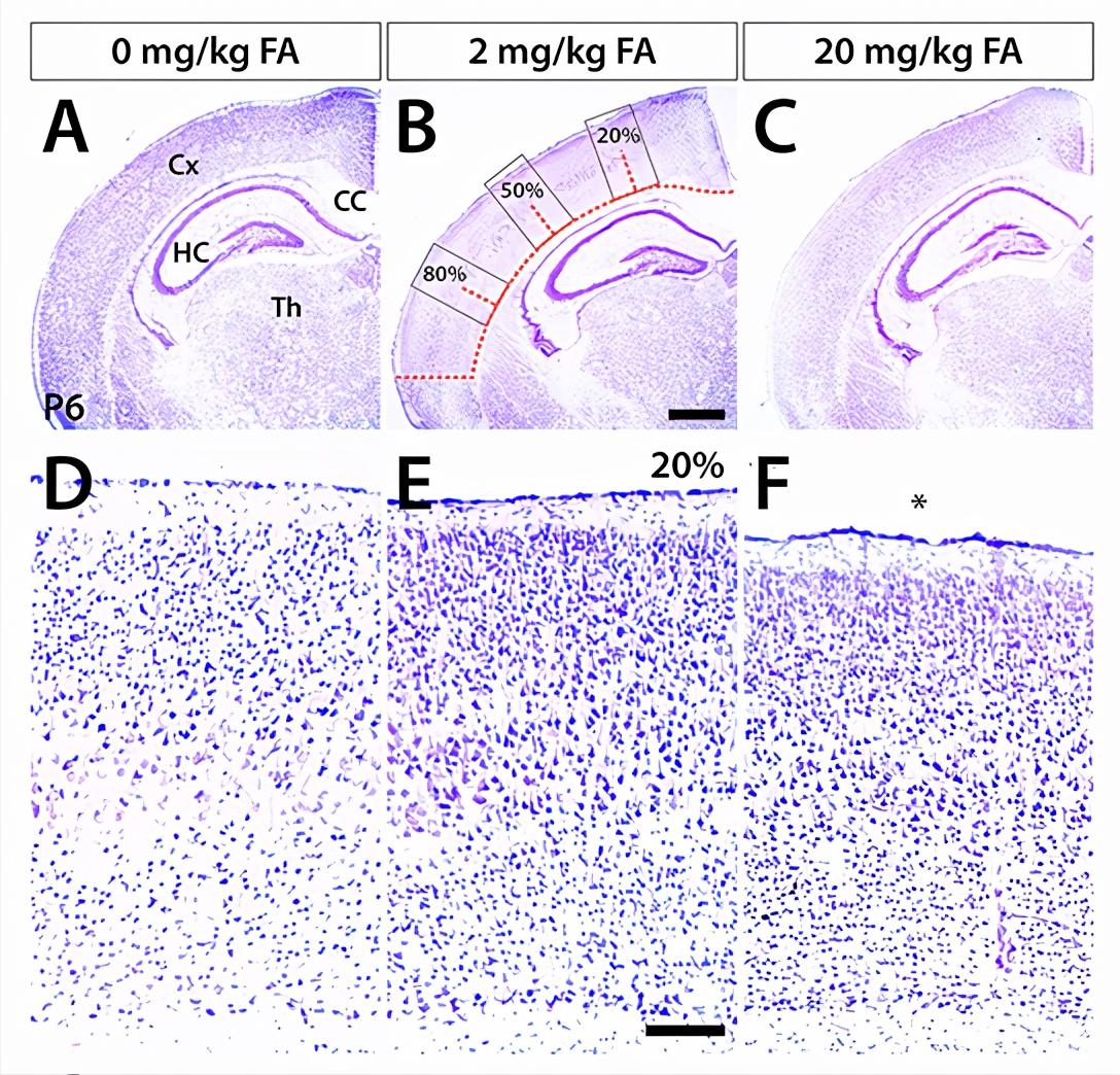 孕妇检查叶酸中度风险很可怕吗,孕妇查出来缺叶酸的危害