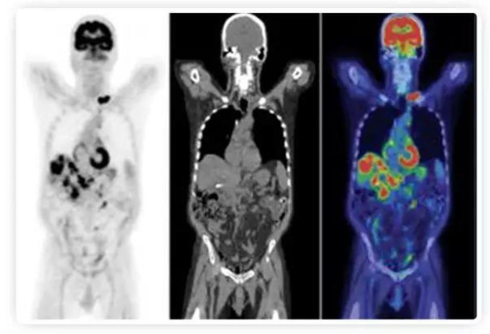医用粒子加速器,医用加速器的原理
