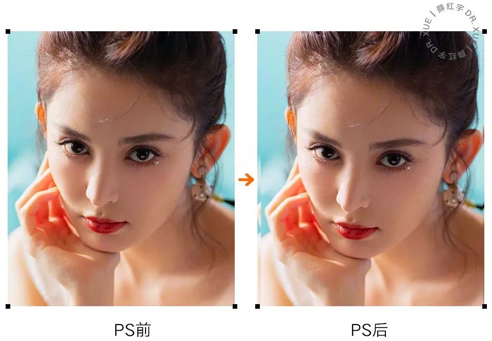 从美术角度谈眯眯眼,开内眼角传统术式