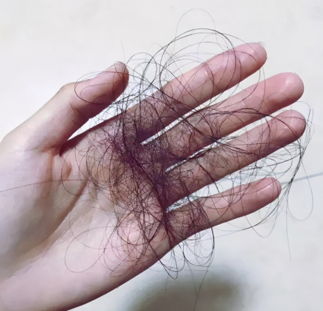 快速增长头发的生发洗发水,发量少用生发洗发水有效吗