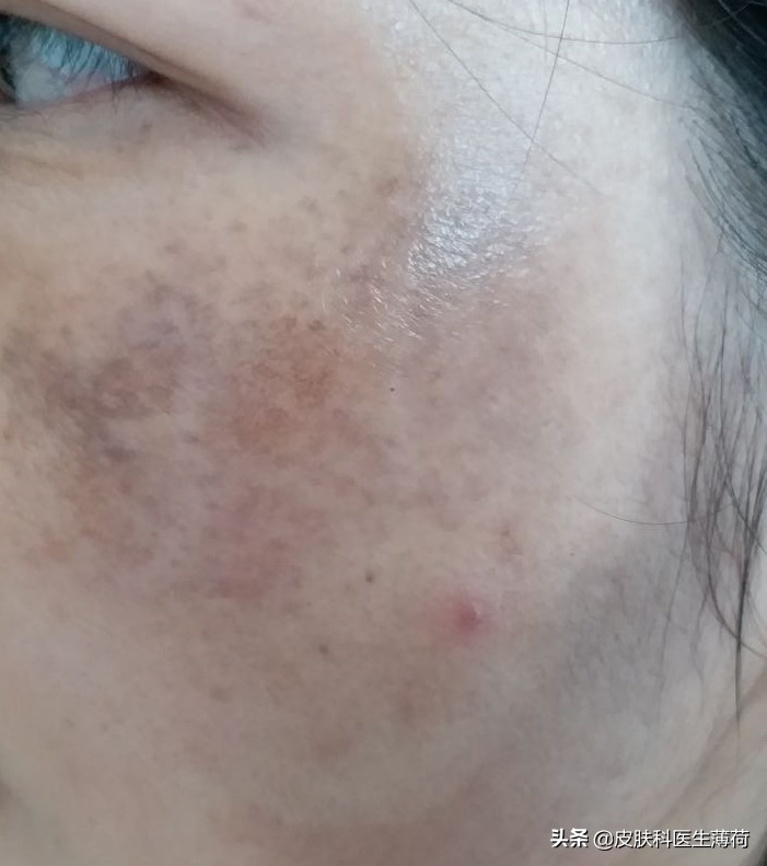 看图识皮肤病,看图识病是什么病