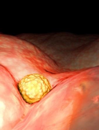 胎儿发育全过程标本,是否能看到胎儿的发育过程