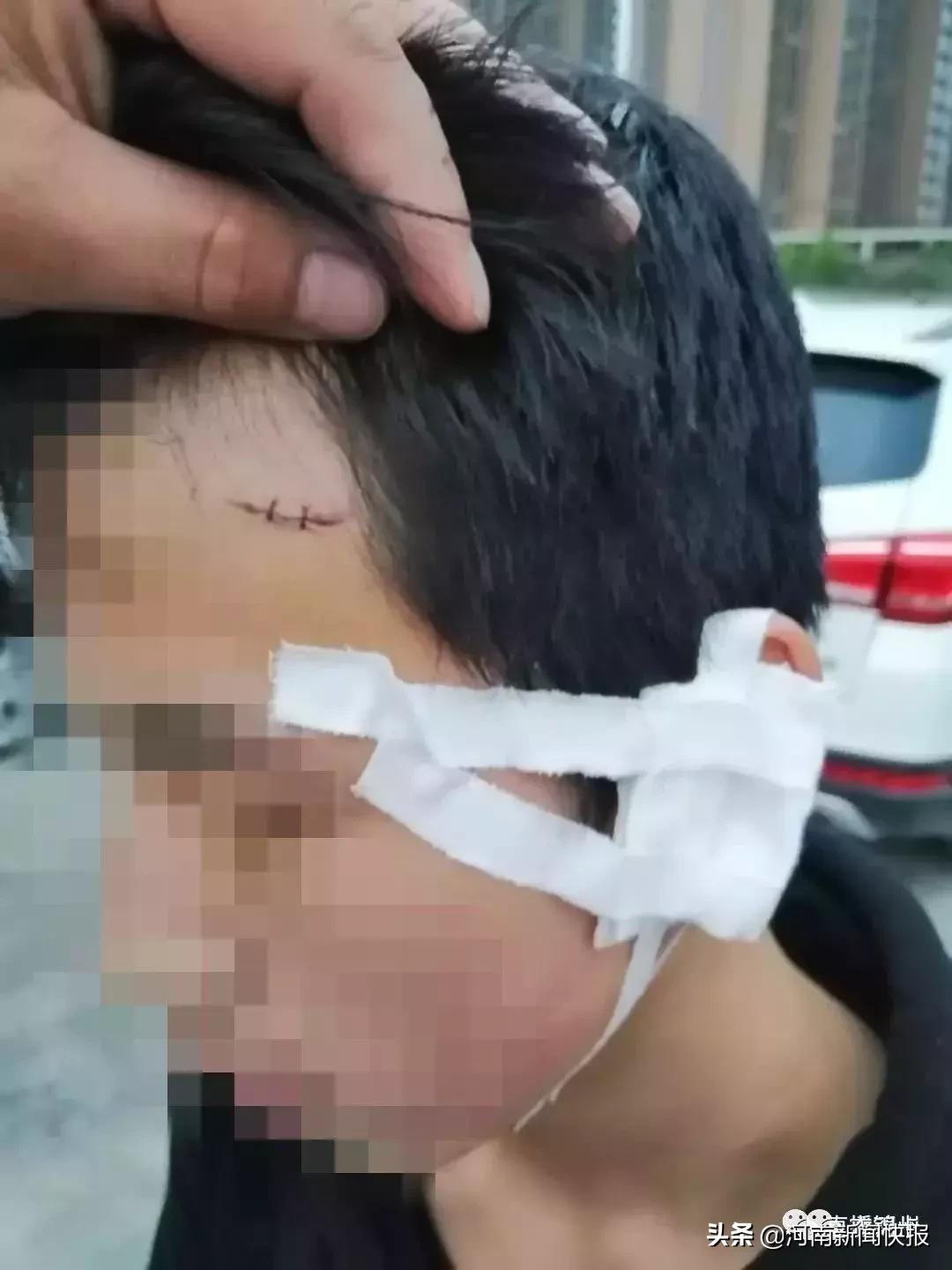 邓州新闻翰林学校打架事件,河南邓州致远中学教师殴打学生案