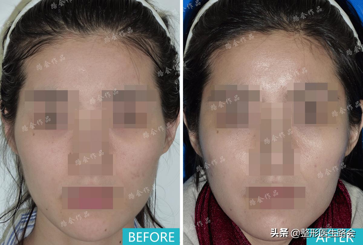 黄晓明颧骨高吗,颧骨高一仰头都凸出来了