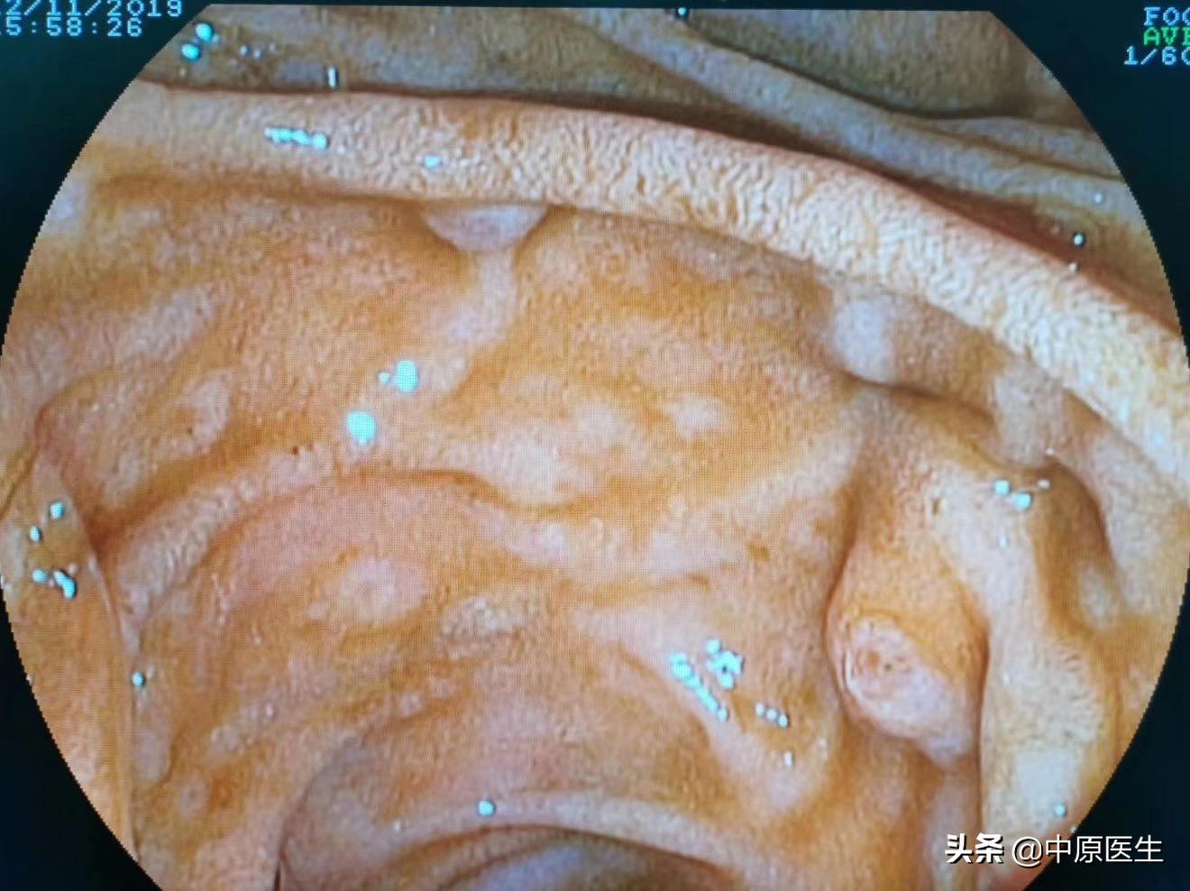 十二指肠与哪个器官对应,与十二指肠相邻的有哪些器官