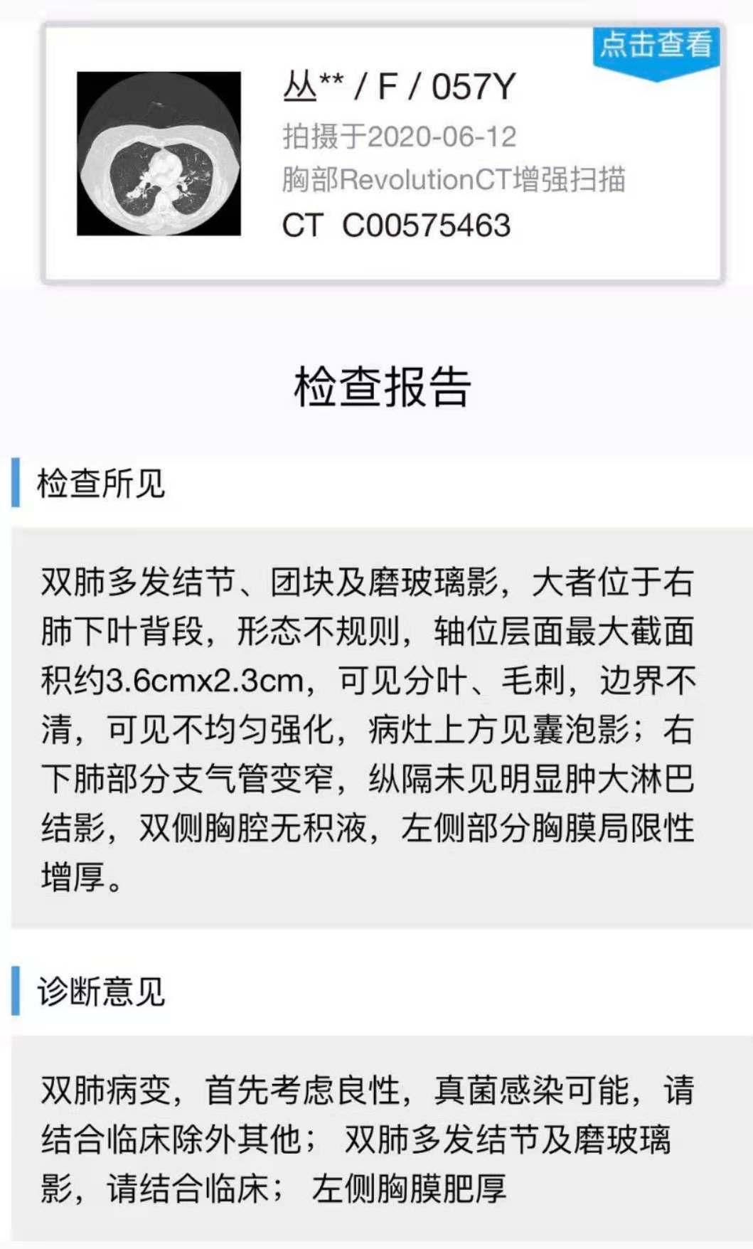 肺癌晚期一副中药活了五年真的吗,一天要三千块以上的治疗费