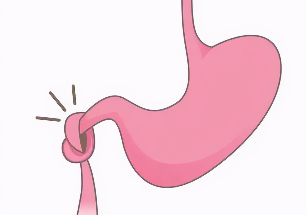 慢性糜烂性胃炎要注意什么,糜烂性胃炎需要多长时间才能治愈