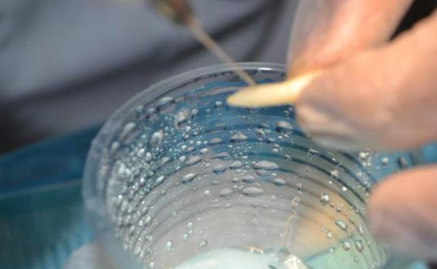 牙齿意外掉落可以救回来吗,牙齿意外脱落3小时可重新装上吗