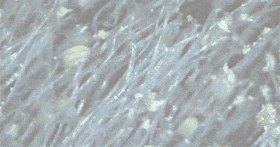 英国珀婷pertine除螨喷雾剂,瑞士珀婷pertine除螨喷雾剂