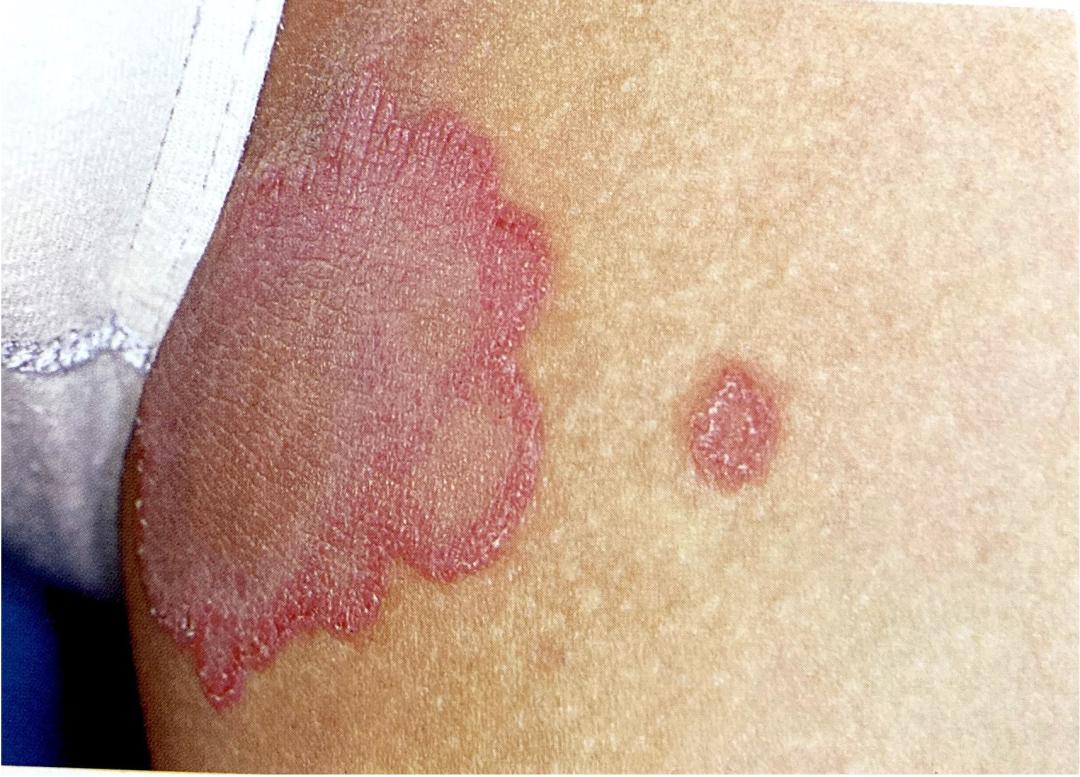 看着身上一片片“玫瑰花瓣”，我把怀疑的目光投向了猫咪