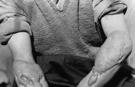 核辐射对人的危害视频,核辐射的危害及分析