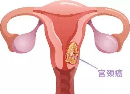 2022年陕西商洛hpv疫苗预约时间,陕西hpv疫苗九价2021年预约时间