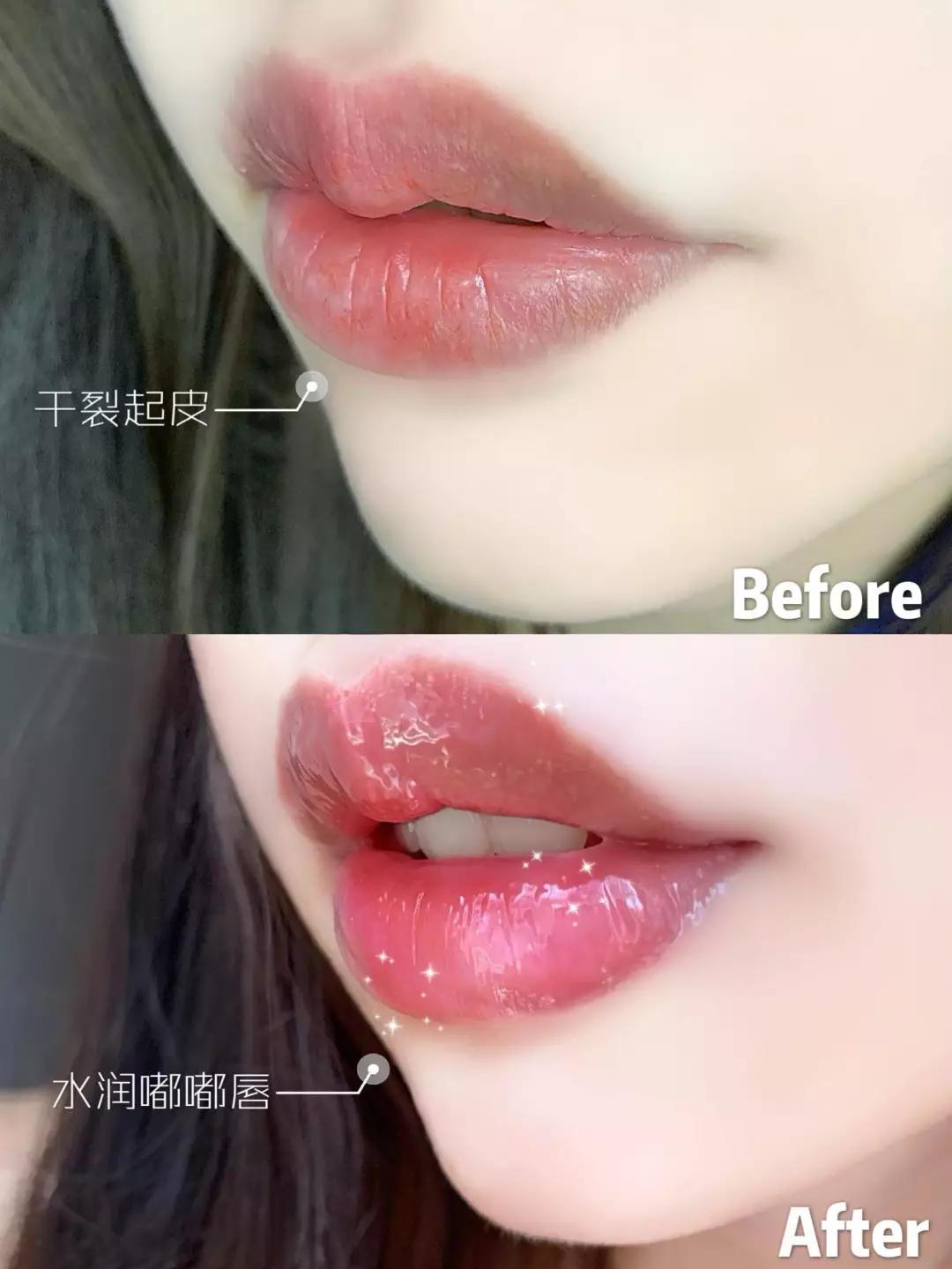 迪丽热巴嘴唇厚,正确脸部护肤步骤迪丽热巴