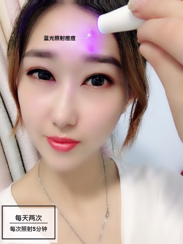 祛痘神器黑科技,祛痘黑科技美容仪