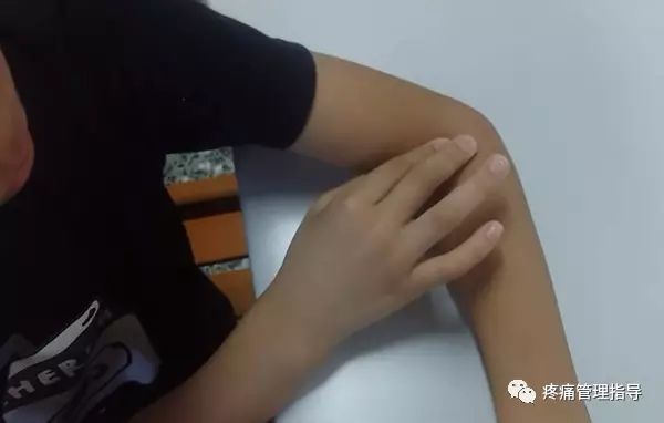 网球肘能自我恢复吗,网球肘病因的解剖学研究