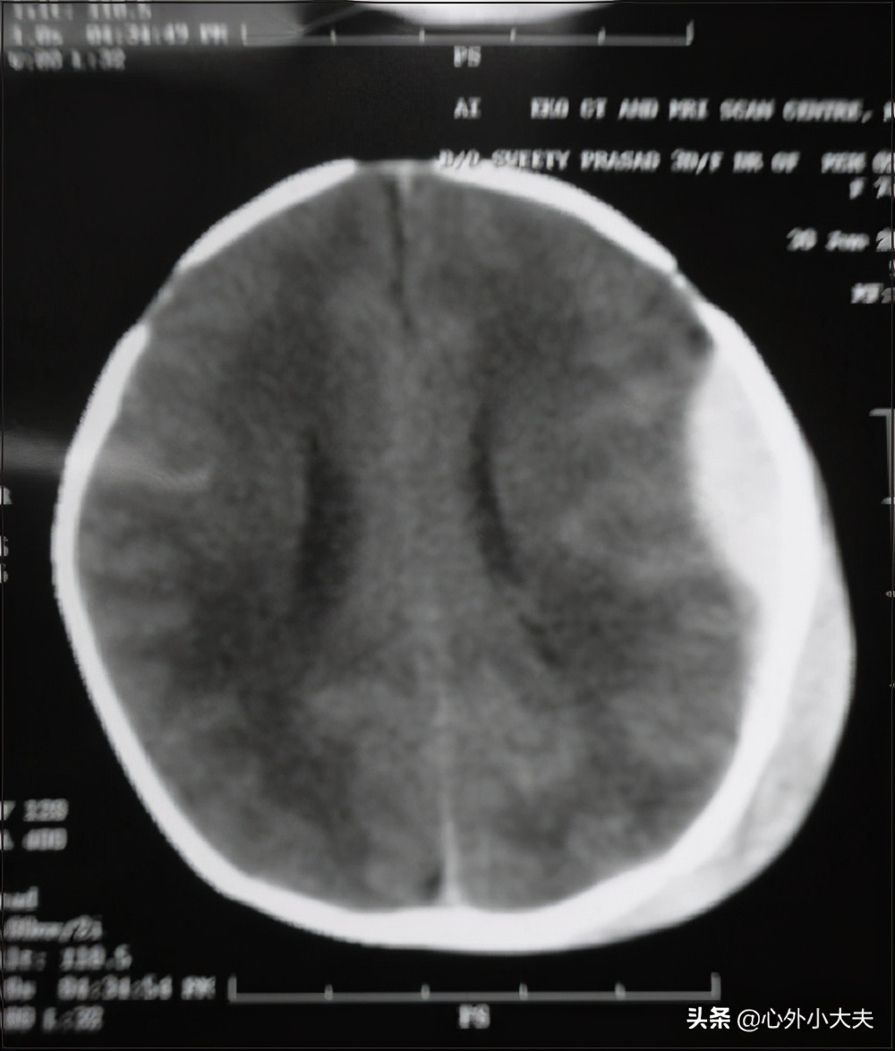 小儿外科常见疾病有哪些,儿童常见的外科疾病有哪些