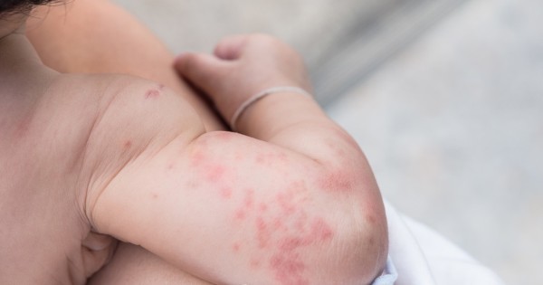 清风计划儿童吃饭,宝宝食物延缓过敏