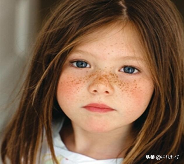 脸上长斑怎么办教你一个小妙招,脸上有斑怎么消除黑斑