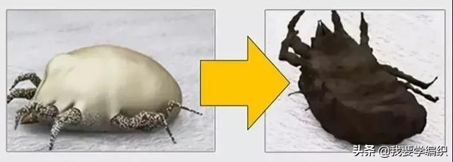 后背长痘的原因和改善方法,后背长痘太可怕了该怎样调理