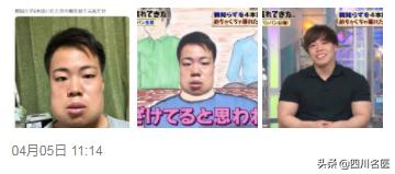 智齿一次拔几颗比较好,智齿到底要不要拔掉一个视频