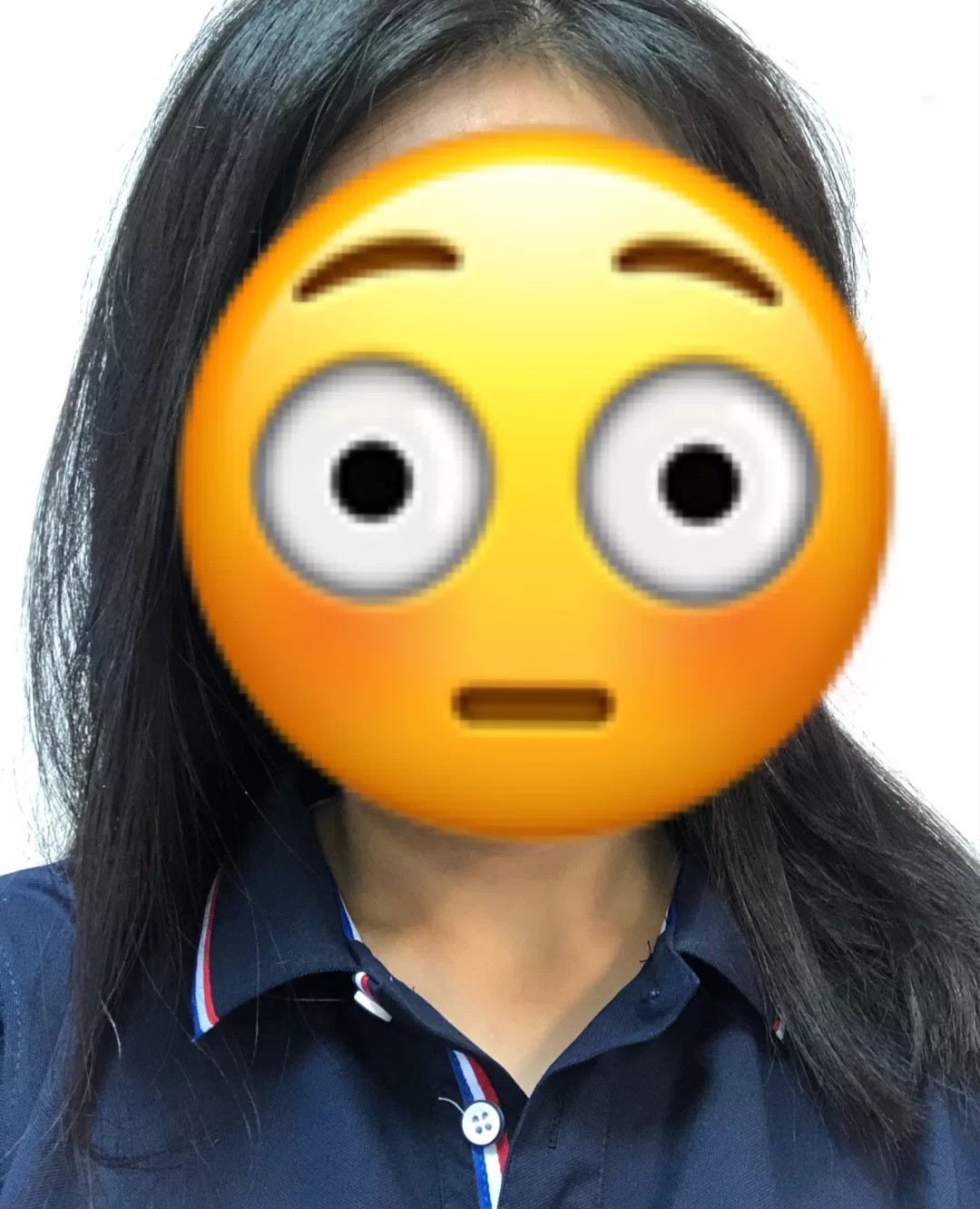 17岁高中生甲亢能彻底治愈吗,20岁小姑娘患上甲亢会治愈吗