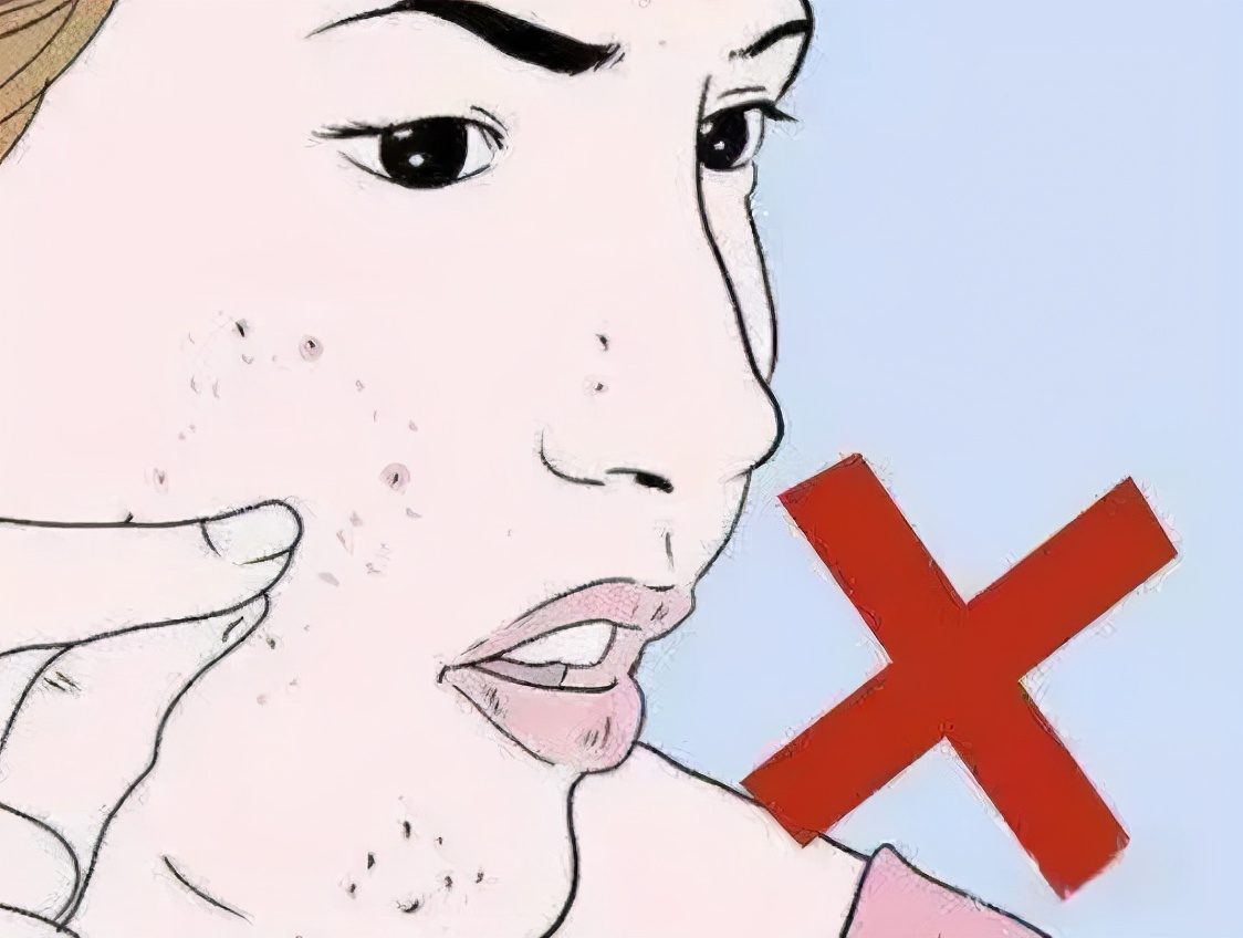 祛痘痘祛黑头祛痘印面膜,有哪些祛痘痘和祛痘印的产品