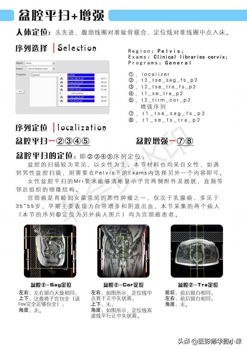 磁共振扫描技术西门子,西门子磁共振最新操作界面