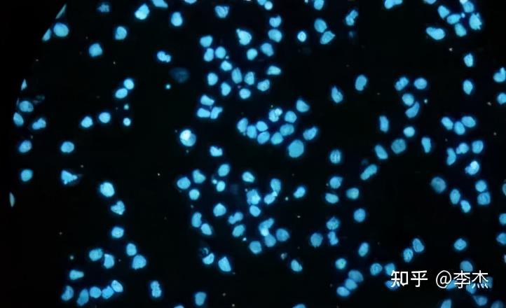 细胞被支原体污染怎么处理,细胞培养如何应对支原体污染