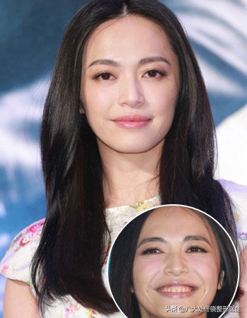 才20岁脸上有皱纹咋回事,才20岁就有皱纹了怎么办