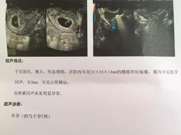 姑娘，如果你不得不流掉肚子里的小生命，请务必看完此文