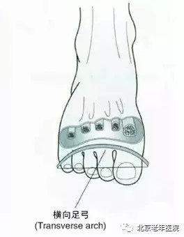 崴脚的预防和治疗,医生分享案例崴脚的科学治疗