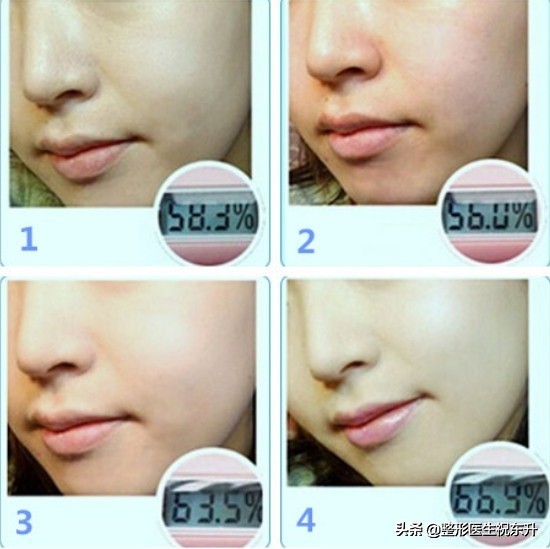 刚打完水光针没几天，肌肤这是“触底反弹”?