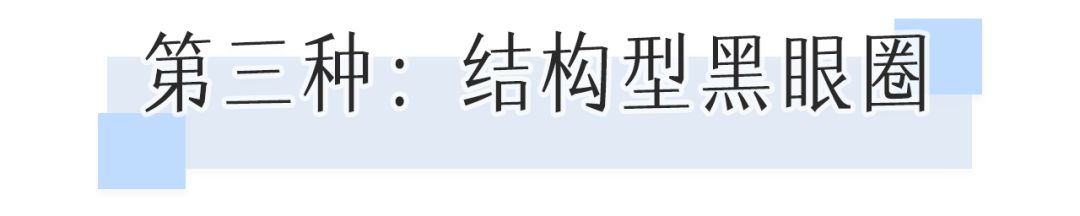 一次就能让黑眼圈消失的办法,一针下去瞬间没了黑眼圈