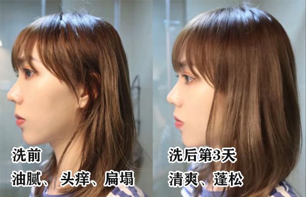 明星亲测有效的护肤品,明星亲测