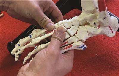 跑步造成脚踝内侧骨头部位疼痛,跑步脚踝肿痛怎么消除