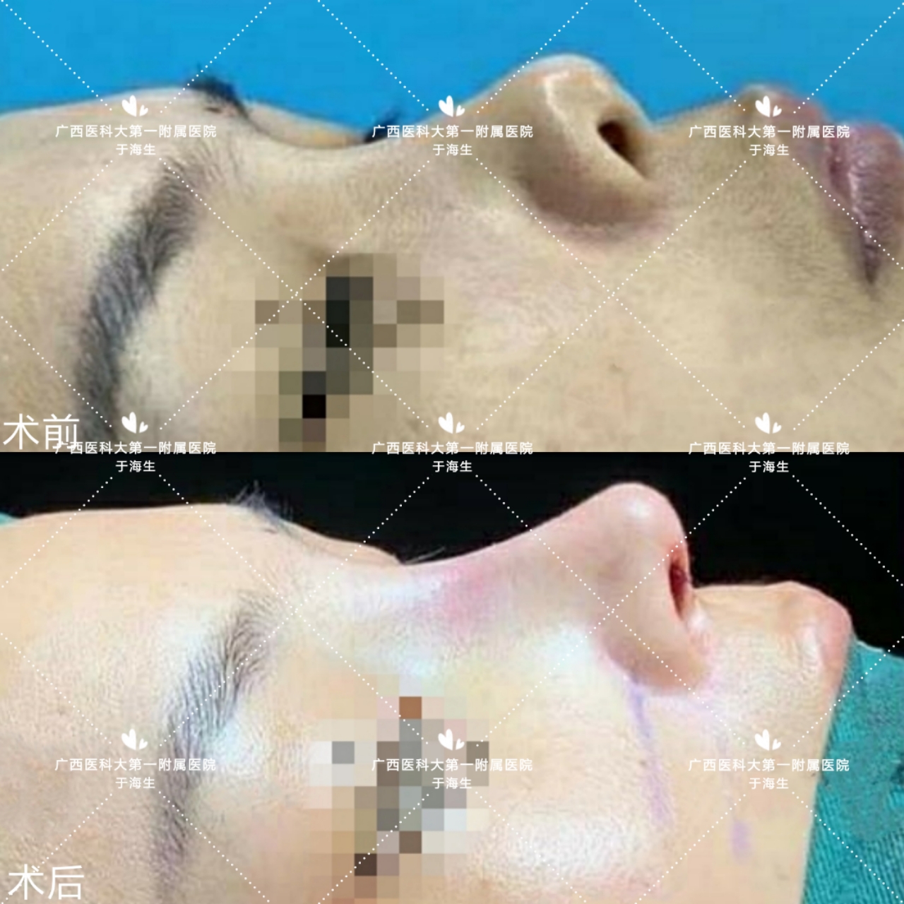 朝天鼻女明星图片,塌鼻好看的明星