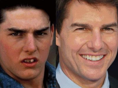 为什么医生不建议牙齿矫正呢,为什么医生不建议矫正牙